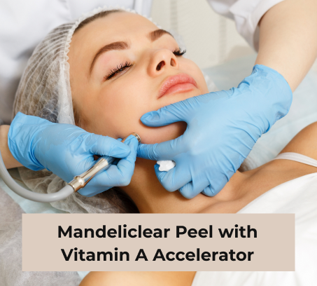 Mandeliclear Peel with Vitamin A Accelerator