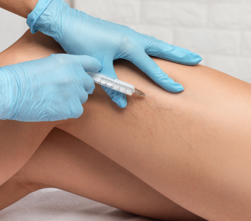 a professional applying a sclerotherapy injection to a woman's leg